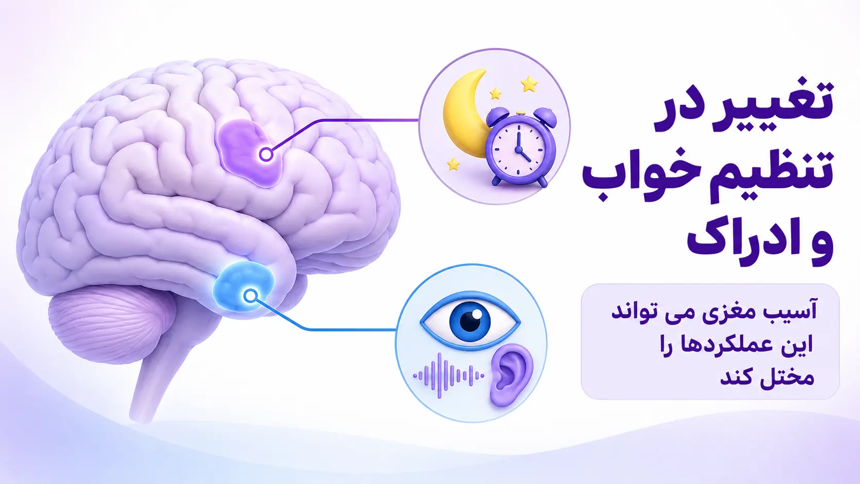 علت بی&zwnj;خوابی و توهم بعد از سکته مغزی