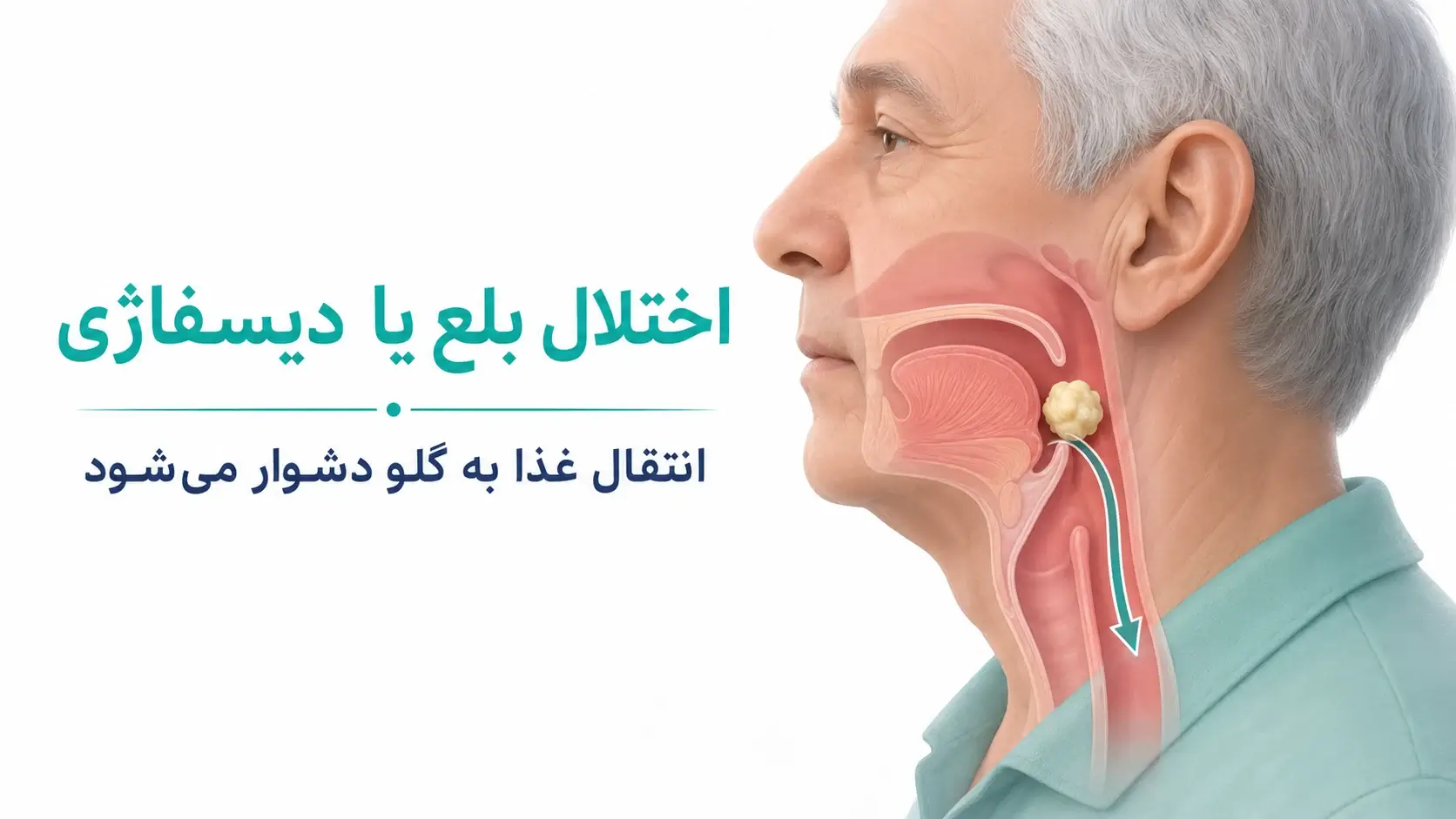 مشکلات بلع بعد از سکته مغزی چیست؟