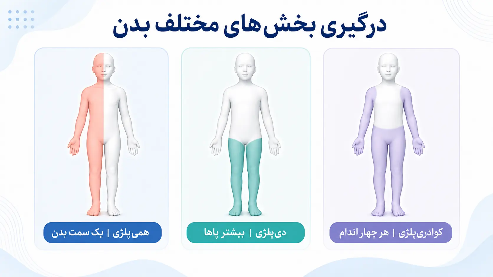 انواع فلج مغزی بر اساس بخش&zwnj;های درگیر بدن